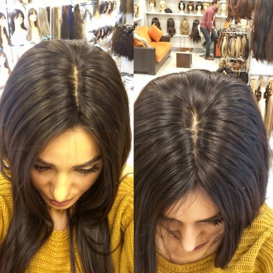 Gerçek Saç Peruk Ankara Doğal Peruk Tepe Kısmı Deri Görünümlü El İşçiliği İle