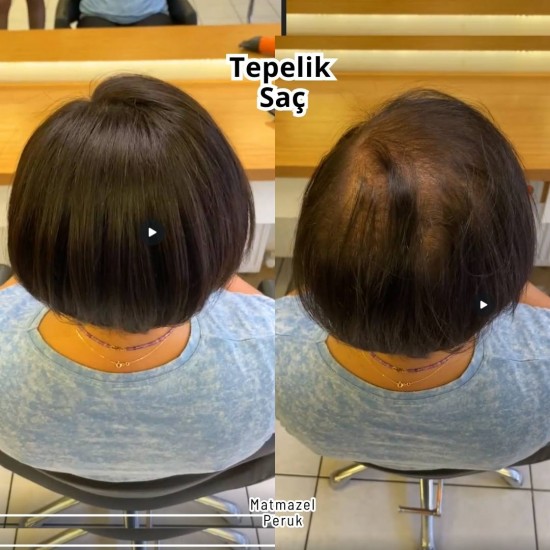 En İyi Tül Tepelik İpek Taban Tepelik Mağazası Ankara