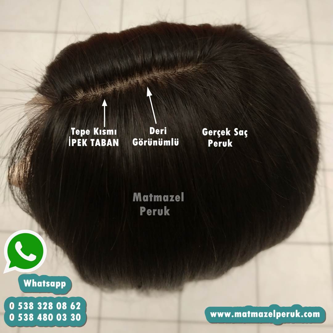 kemoterapi peruk alopesi peruk