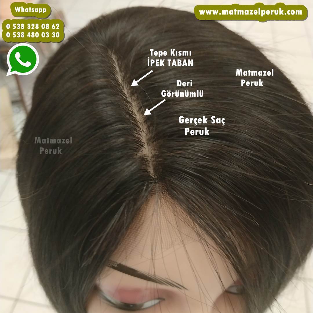 kemoterapi peruk alopesi peruk