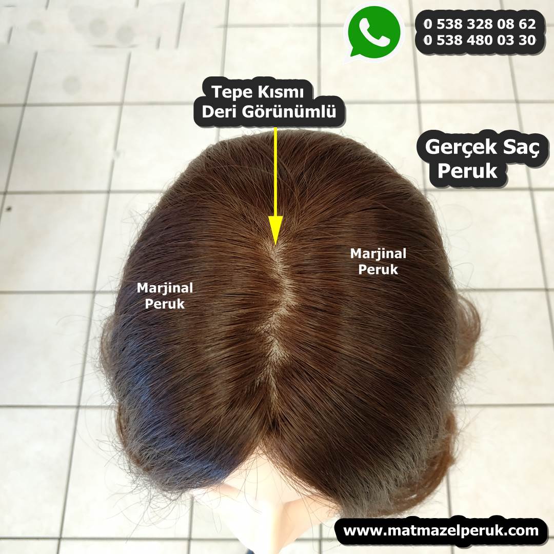 kemoterapi peruk alopesi peruk