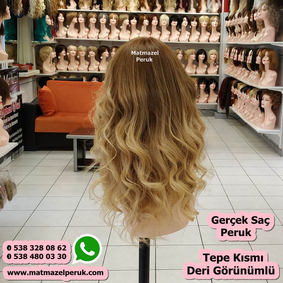 alopesi peruk