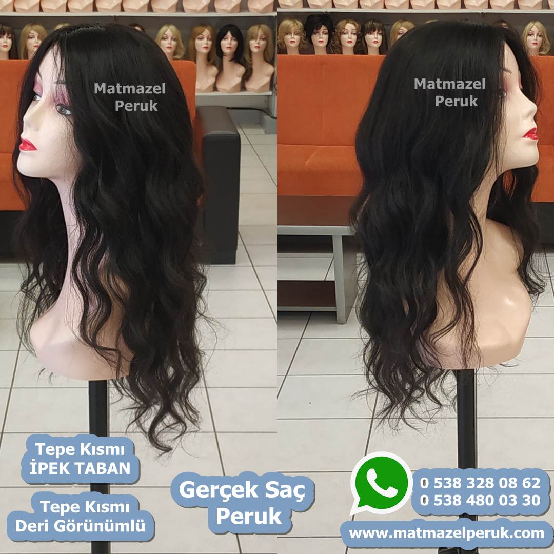 alopesi peruk